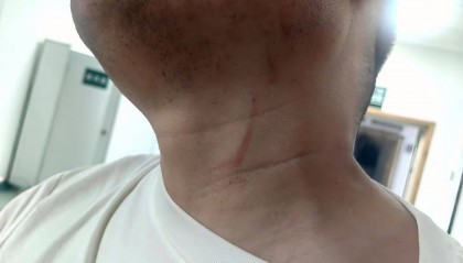 武汉男子拍摄违停时被当街殴打，打人者被罚款500元，被打者称将提起行政复议并起诉